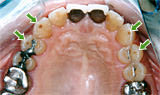 歯の表側