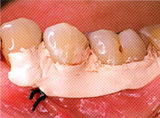歯周外科のイメージ写真
