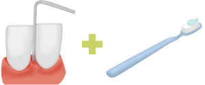 歯周検査+歯磨きイメージ