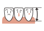 歯の長さイメージ